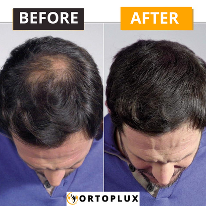 Hair Density Filler