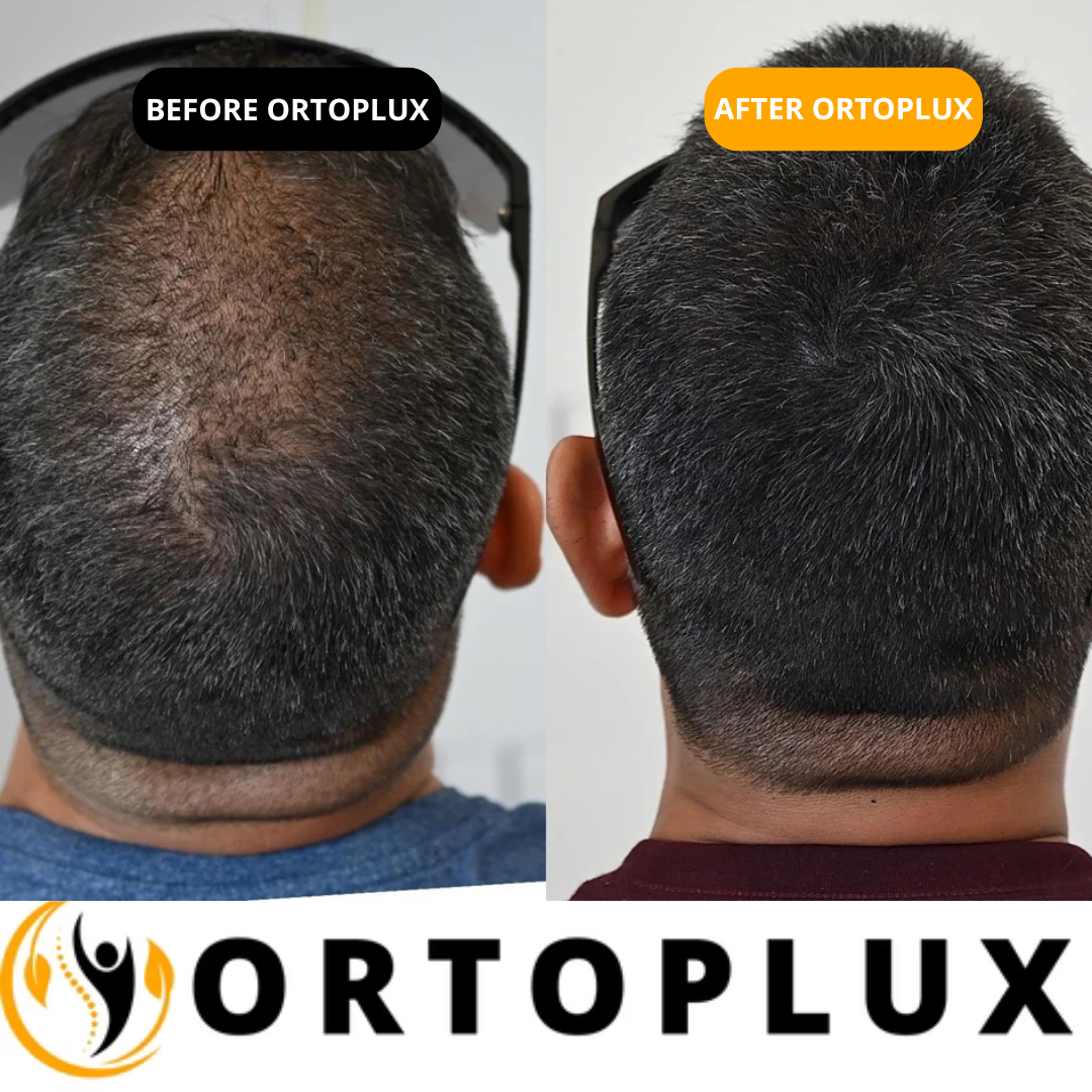 Hair Density Filler