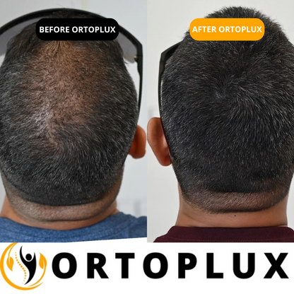 Hair Density Filler